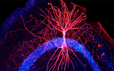 Neurons HP