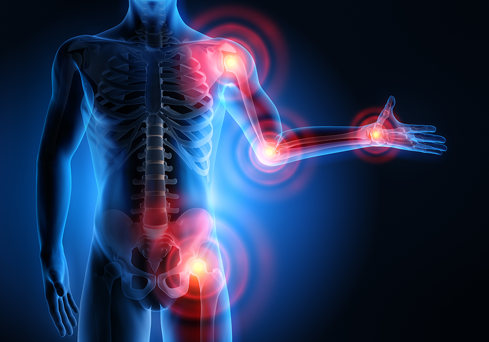 Pain points in the body